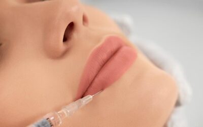 Medikal Estetik Uygulamaları 1 Dudak Dolgusu Nedir? Hyaluronik Asit İle Doğal ve Hacimli Dudaklar